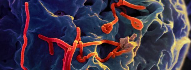 Um exame de sangue para calcular a mortalidade do ebola