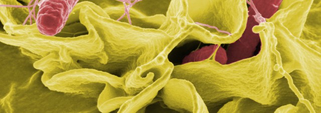 As bactérias que trouxeram à luz a “Capela Sistina” valenciana