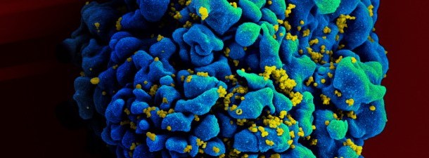 Como melhorar a eficácia dos tratamentos contra o HIV?