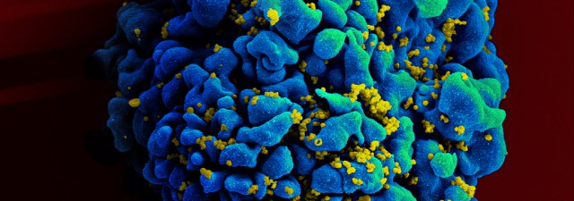 Como melhorar a eficácia dos tratamentos contra o HIV?